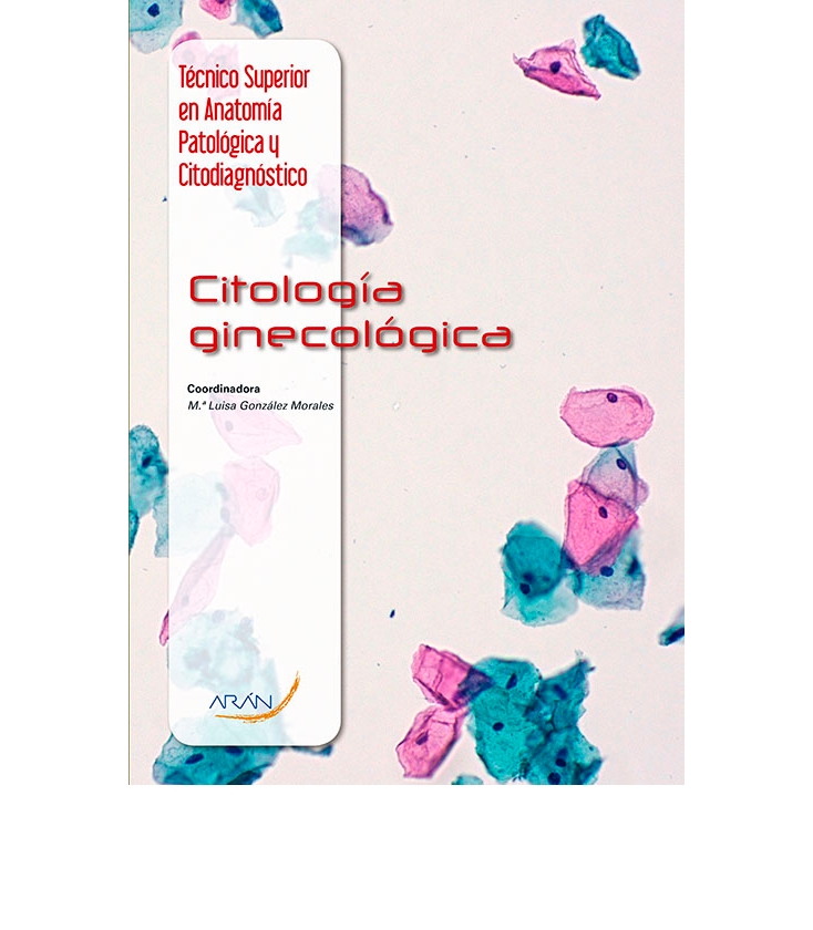 Que Es La Citologia Cervical Vaginal Y Ejemplos