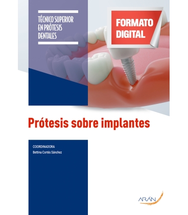 Prótesis sobre implantes. 2.ª ed.