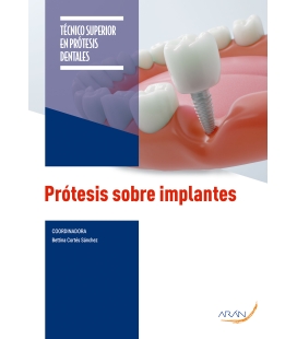 Prótesis sobre implantes. 2.ª ed.