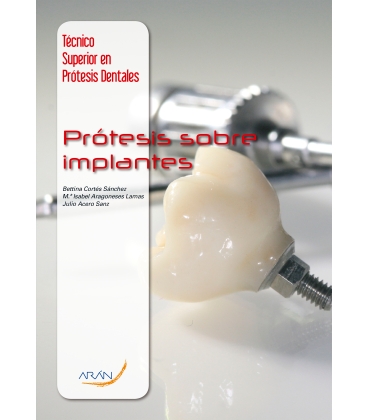 Prótesis Sobre Implantes
