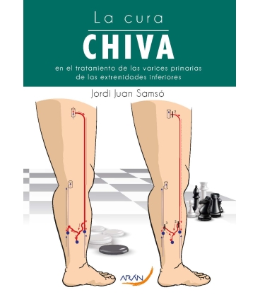LA CURA CHIVA EN EL TRATAMIENTO DE LAS VARICES PRIMARIAS DE LAS EXTREMIDADES INFERIORES