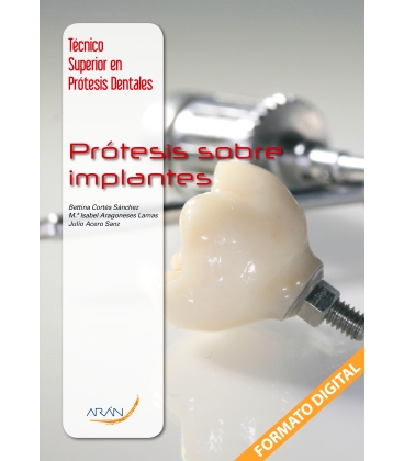 Prótesis Sobre Implantes